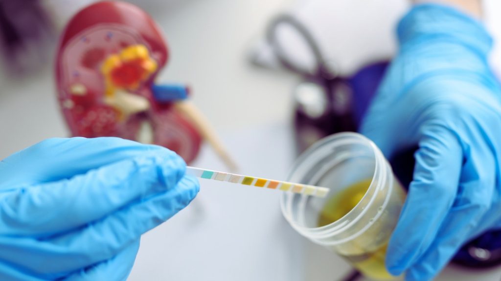 Urine immunoassay screening used in benzodiazepine drug testing