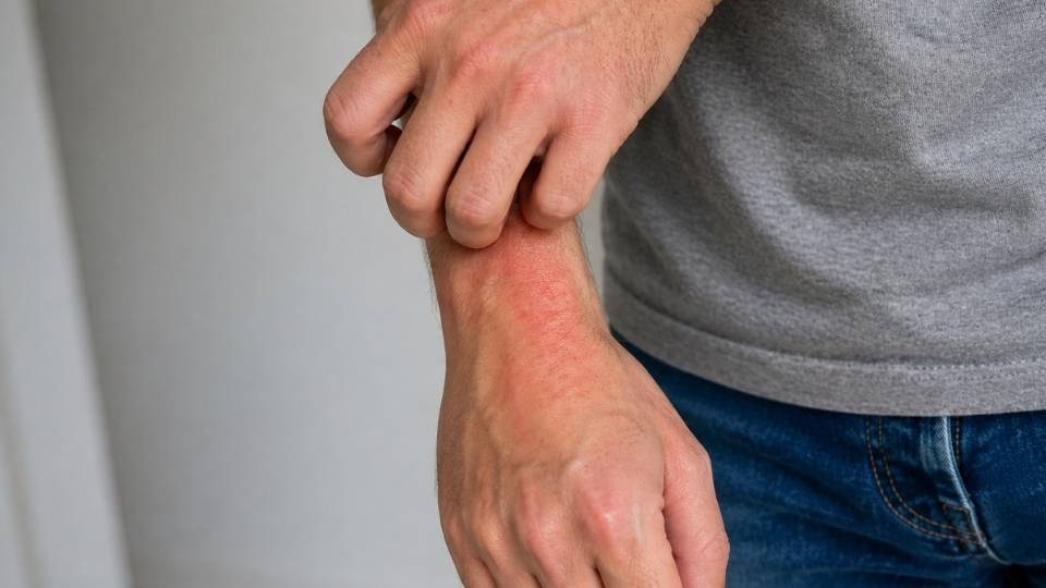 Meth Sores Why Methamphetamine Causes Skin Lesions Hero Image of man scratching his arm.